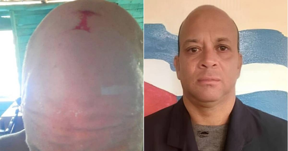 Periodista independiente denuncia golpiza y amenazas de muerte por ejercer su labor en Cuba