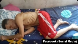 Guillermo del Sol afirma que su salud se agrava al cumplir 39 días en huelga de hambre – Martí Noticias