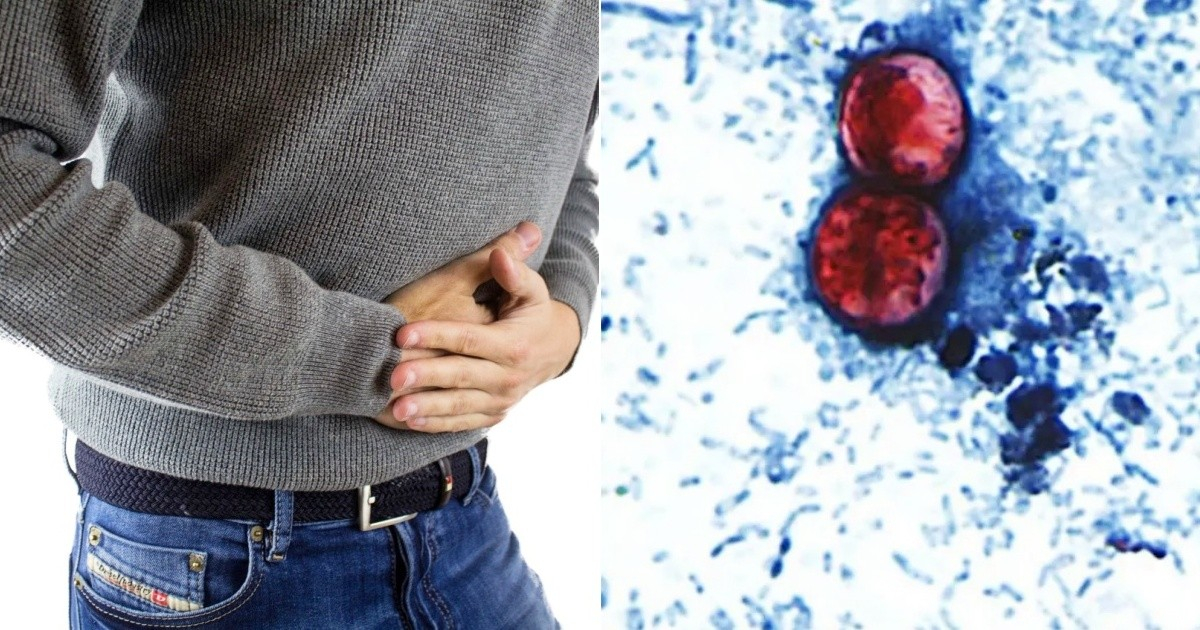 Brote de ciclosporosis se extiende a otros seis estados de EE.UU: ¿Qué se sabe?