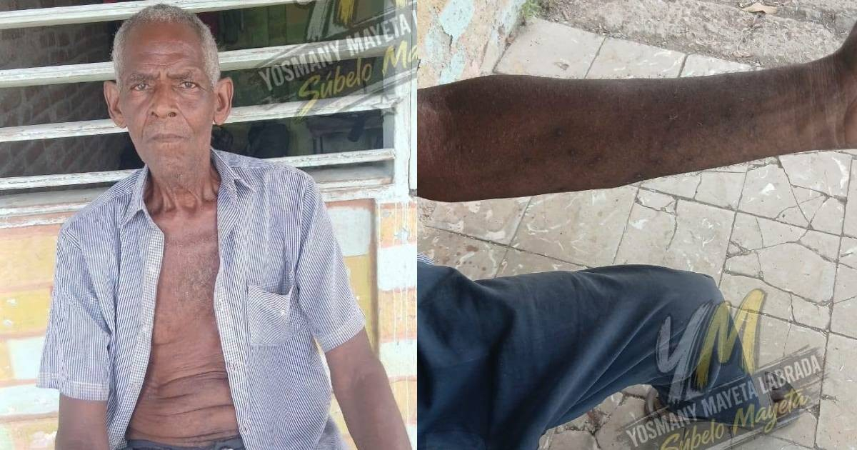 «Búscalo por fuera»: la respuesta que recibió el padre de Yosmany Mayeta ante la falta de medicamentos en Cuba