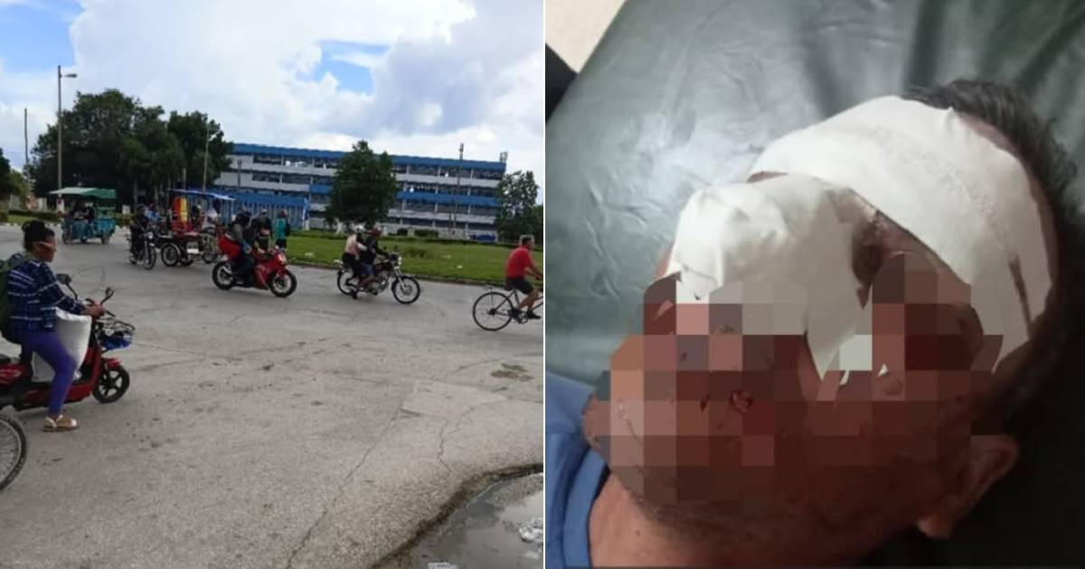 Un ciclista acaba bajo observación médica tras ser golpeado por una moto en una rotonda de Camagüey