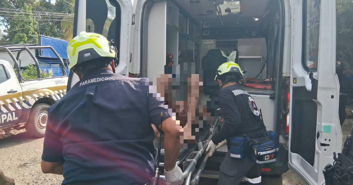 Cubano sufre quemaduras en incendio de vivienda en México: autoridades sospechan que lo provocó