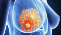 El 19 de octubre, Día Mundial de lucha contra el cáncer de mama